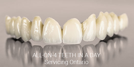 teeth-in-a-day--servicing-ontario